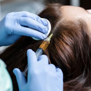 Mesoterapia Capilar