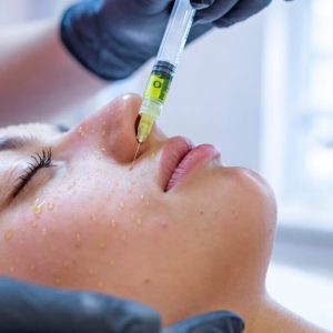 Mesoterapia Facial y Corporal