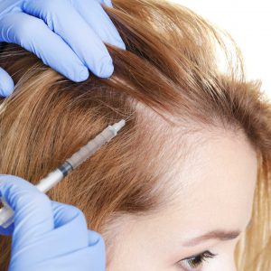 Plasma Rico en Plaquetas o Bioestimulación Autologa