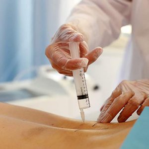 Ozonoterapia