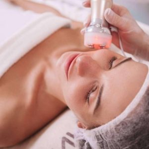 Radiofrecuencia facial