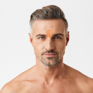 Depilación mentón hombre