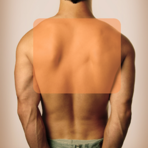 Depilación media espalda superior hombre